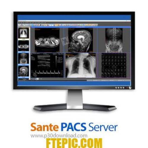 [نرم افزار] دانلود Sante PACS Server PG v3.2 - نرم افزار ذخیره سازی، بایگانی و مدیریت تصاویر پزشکی دیکام